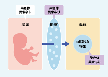 【図2】 CPMが発生した場合